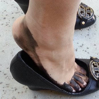scarpe donna piedi macchiati